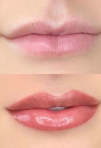 Permanent Lip Colour by Macrocosm Aesthetics