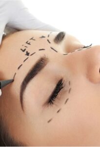 Eyebrows Lift treatment by Macrocosm Aesthetics