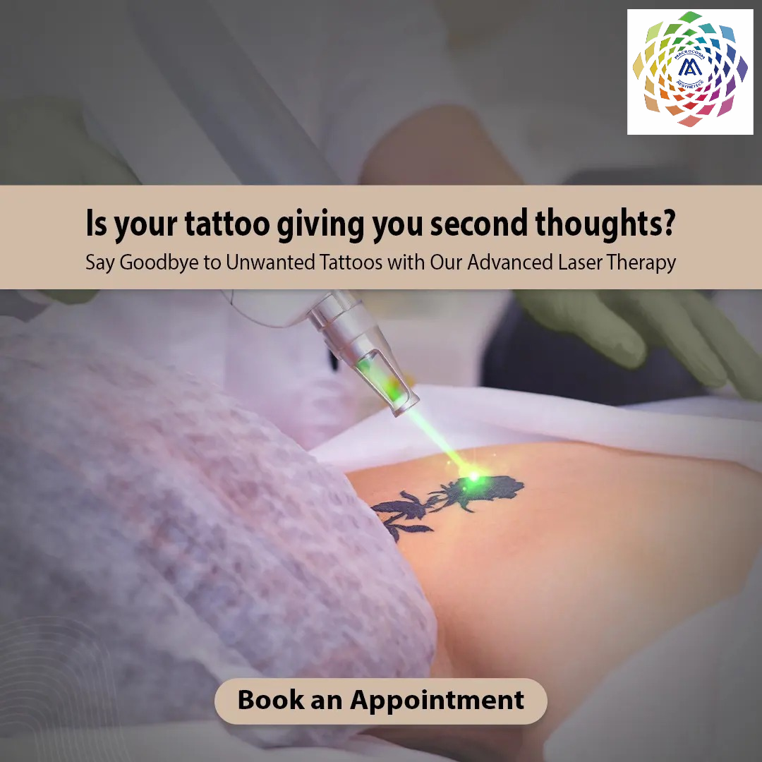 is your tattoo giving you second thought?