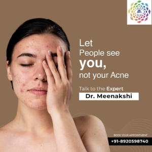 If you are looking for Acne - Diagnosis and treatment Clinic in Delhi contact Macrocosmaesthetics in Dwarka Sector 8 Delhi.
