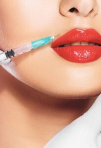 Lip Augmentation treatment by Macrocosm Aesthetics