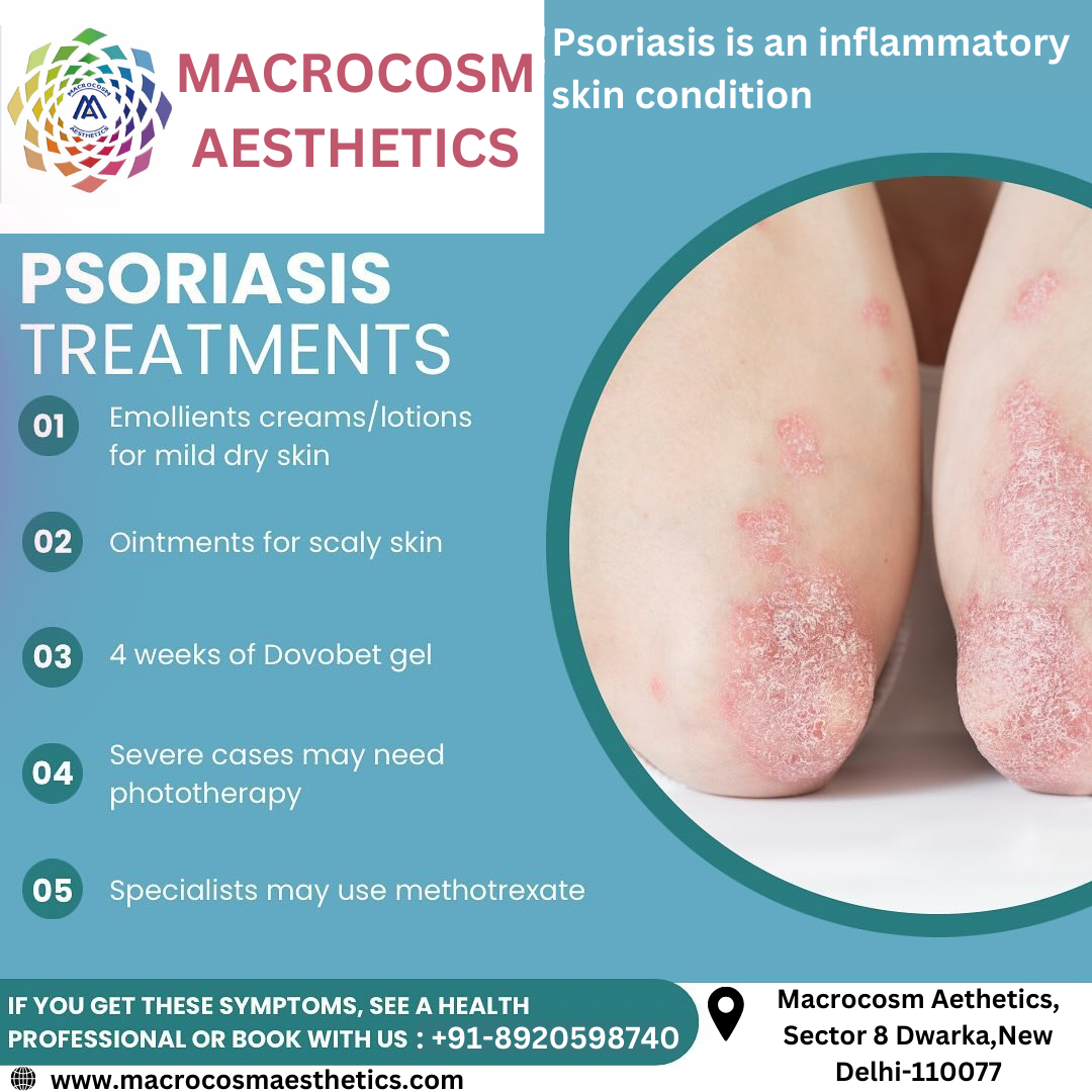 Best Clinic for Psoriasis treatment in Dwarka, Delhi.