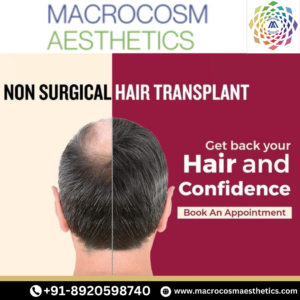 Best Hair Patch Solutions by Macrocosm Aesthetics in Dwarka, Delhi.