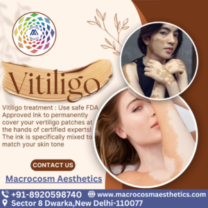 Best clinic for Vitiligo Micropigmentation treatment near Dwarka, Delhi.