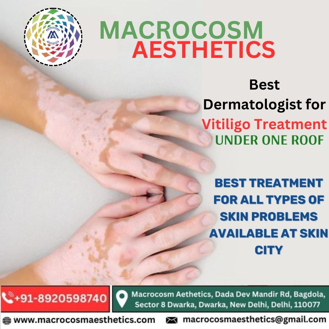 Best Dermatologist for Vitiligo Treatment in Delhi