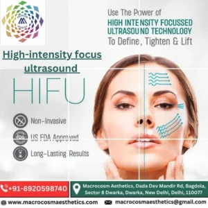Best face uplift treatment by HIFU in Dwarka, Delhi
