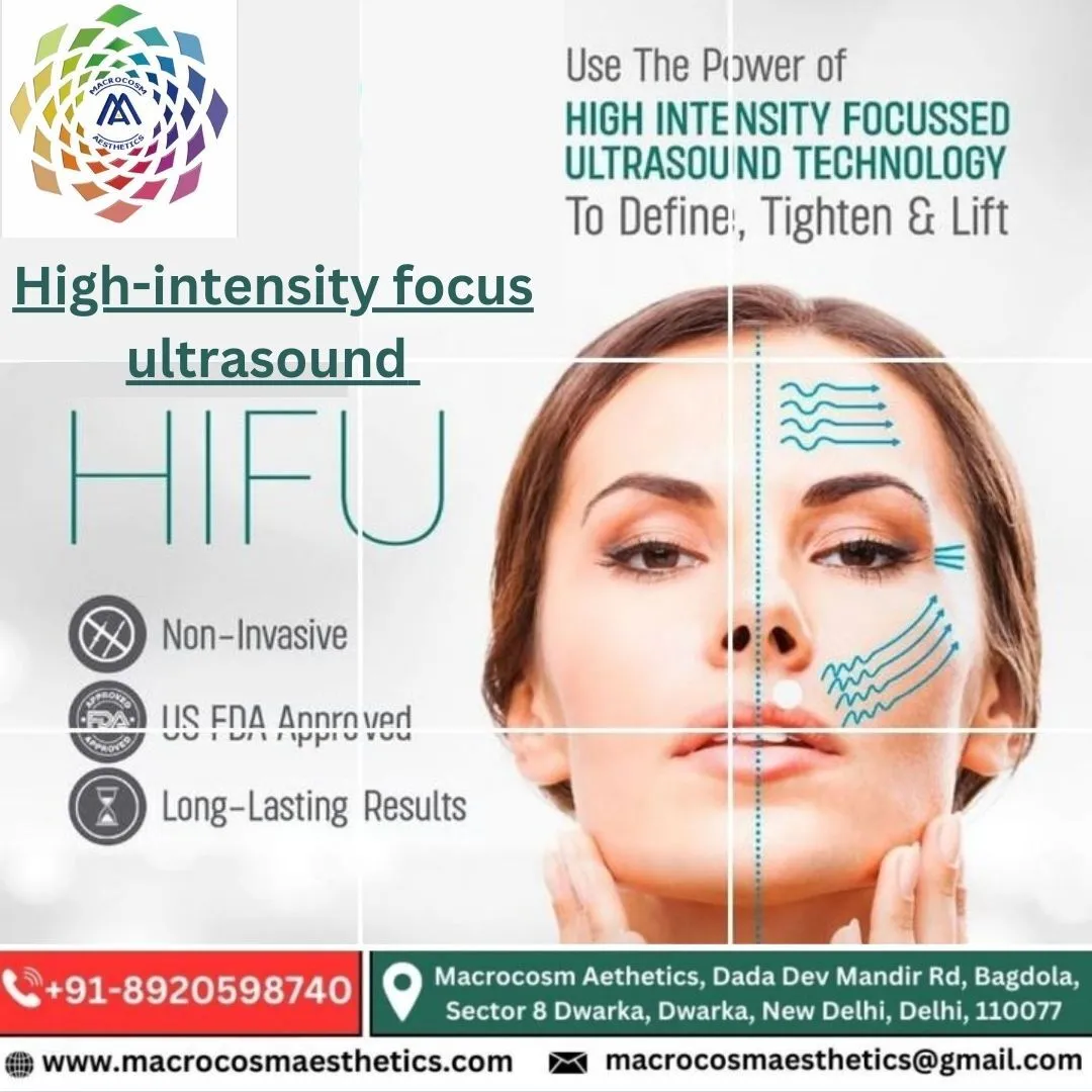 Best face uplift treatment by HIFU in Dwarka, Delhi