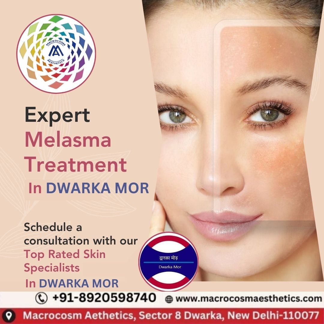 Expert Melasma Treatment in Dwarka, Mor