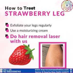 Laser Hair Removal for Strawberry Legs