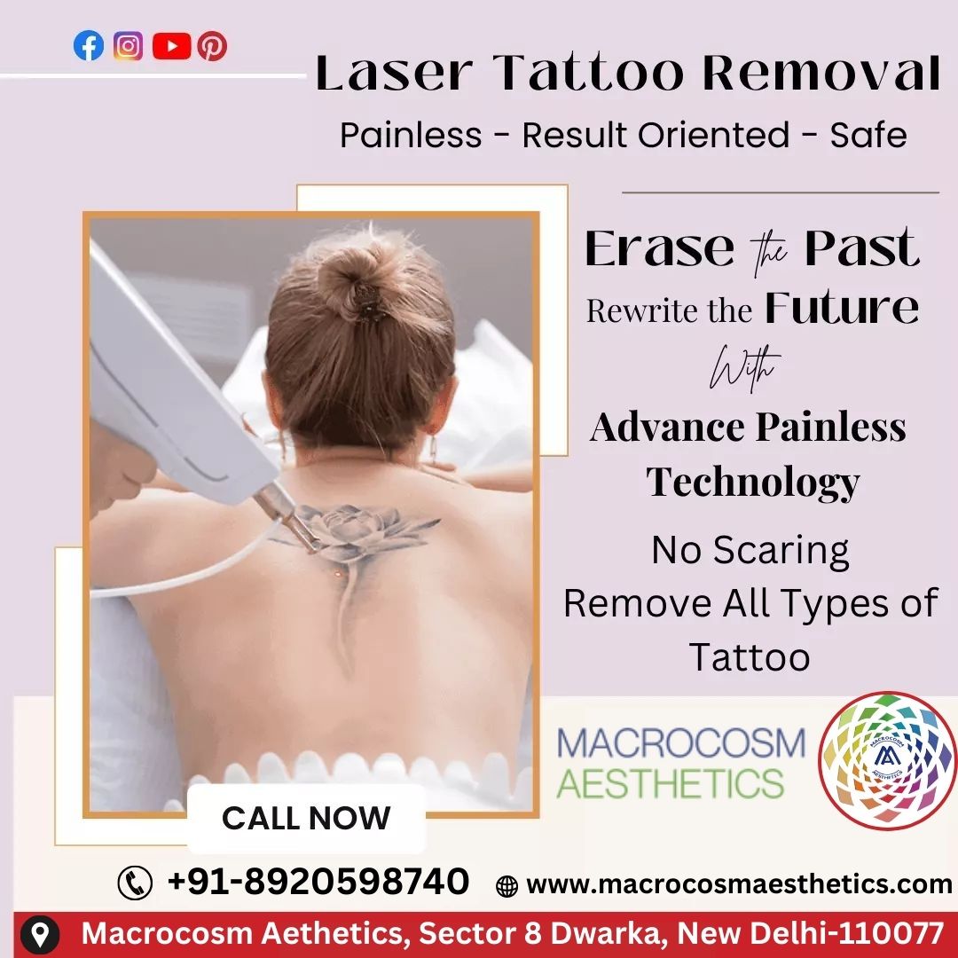 Painless Tattoo removal with Laser treatment