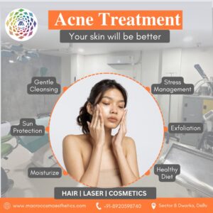 Acne Types, Causes, Treatment & Prevention -Macrocosm Aesthetics