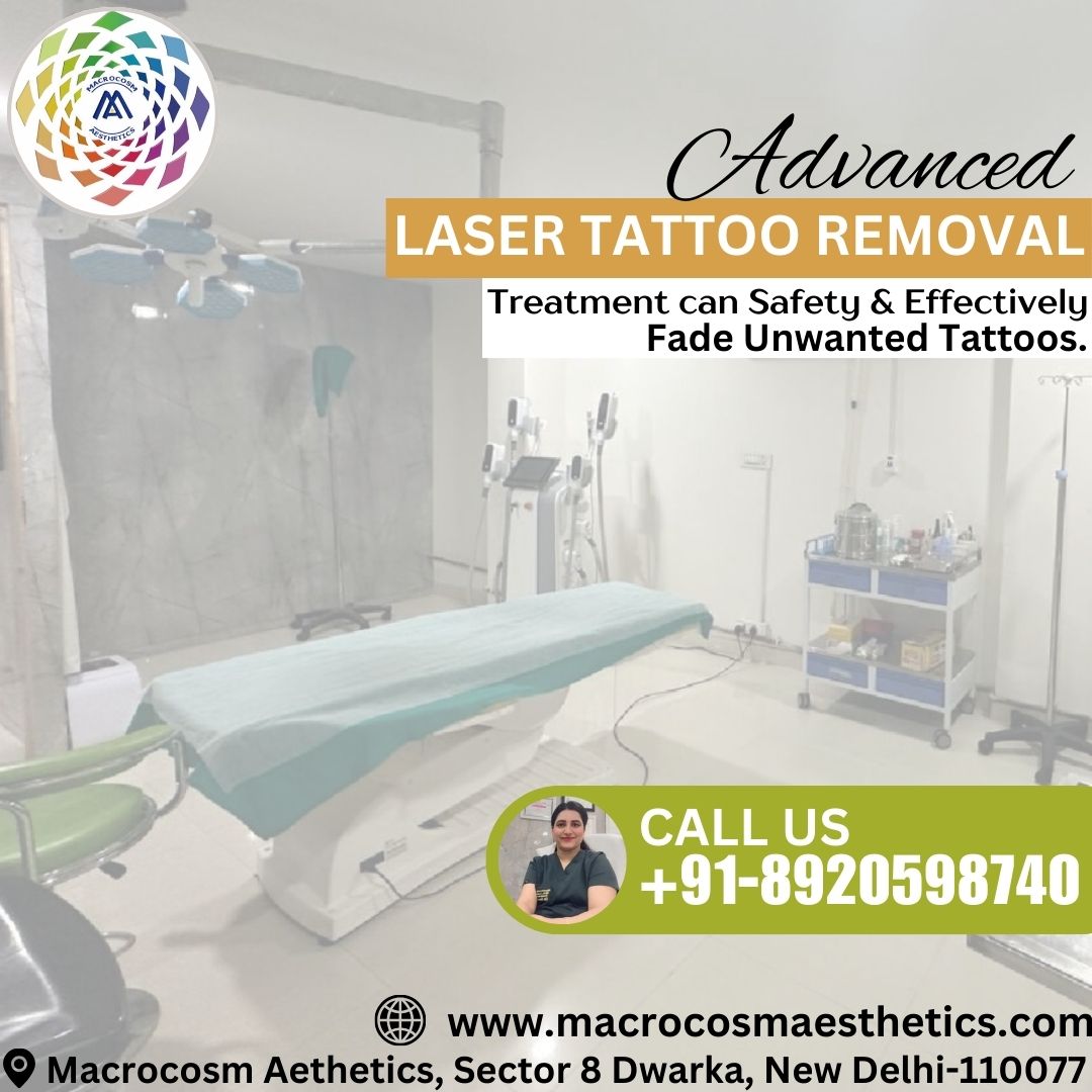 Advanced Laser Tattoo Removal in Dwarka, Delhi