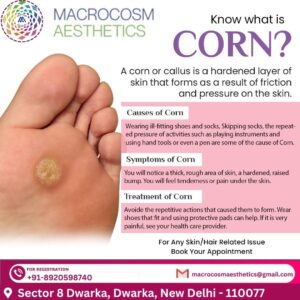 Best Clinic for Corn Treatment in Delhi