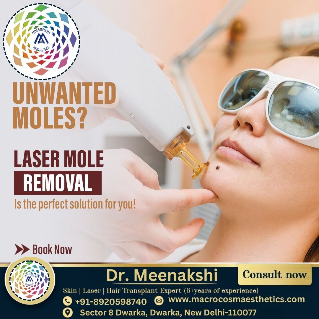 Best Clinic for Laser Mole Removal Treatment