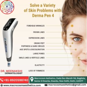 Solve a variety of Skin Problem with Derma Pen 4