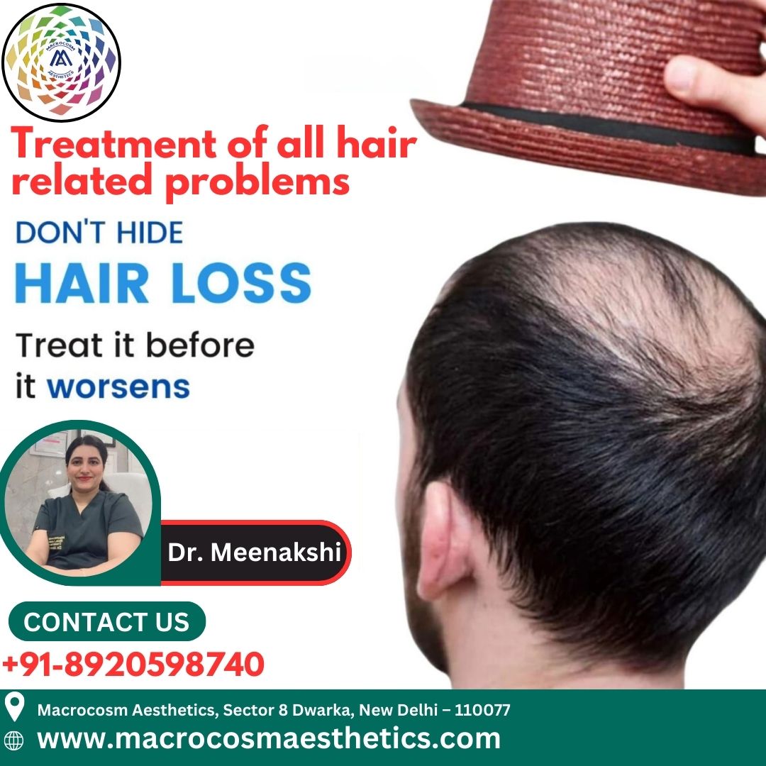 Treatment of all hair related problems